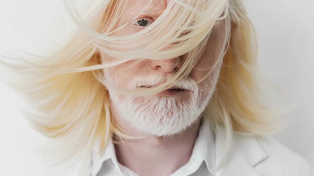 Albino man with beautiful straight hair